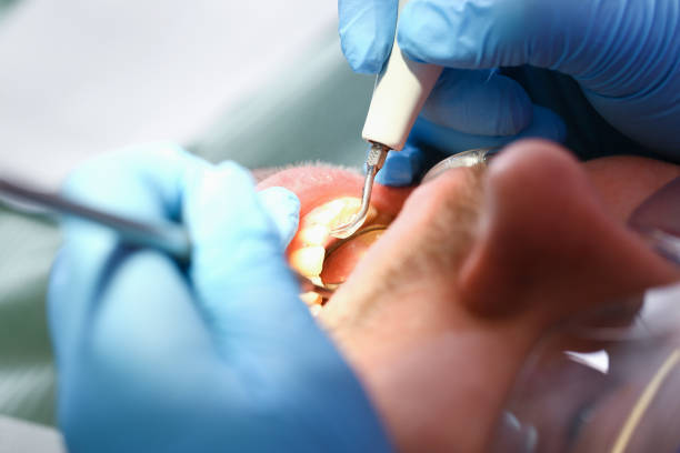 Best Broken or Cracked Tooth Emergency Dentist in Indian Trail, NC
