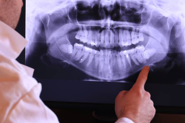 Best Emergency Dentist for Knocked-Out Tooth in Indian Trail, NC